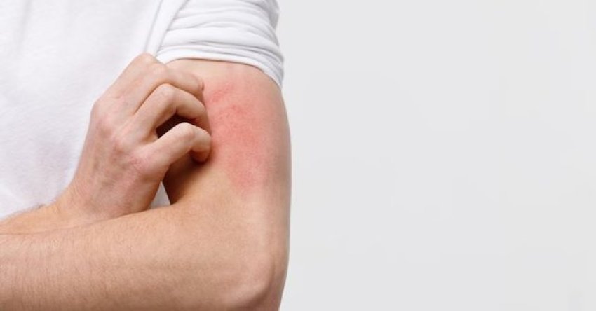 Dermatologët: Kruajtja e trupit mund të fshehë sëmundje serioze