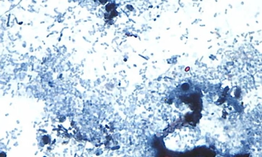 Zyrtarët e shëndetësisë në Michigan identifikojnë ‘shkaktarin e mundshëm’ të helmimit nga ushqimi