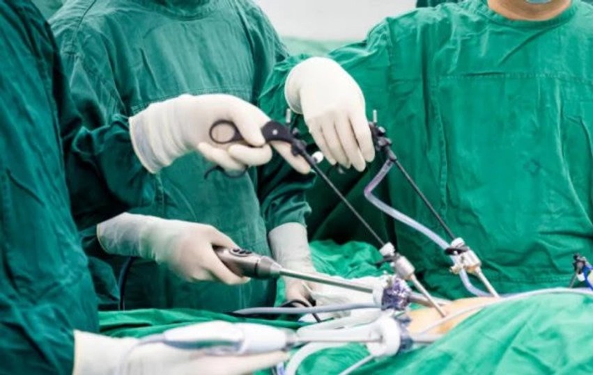 Studimi për kancerin e rektumit jep shpresë për trajtim pa operacion