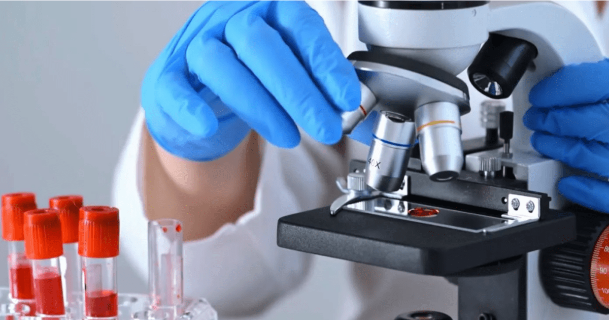 Analiza e re e gjakut mund të shpejtojë diagnostikimin e endometriozës