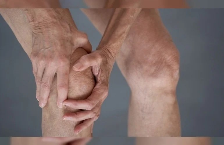 Dhimbja e gjurit mund të lehtësohet nga zorrët: Një suplement me fibra jep shpresë